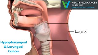 Hypopharyngeal & Laryngeal Cancer (throat) - What Is It? Symptoms & Treatment? Head & Neck Cancer screenshot 2