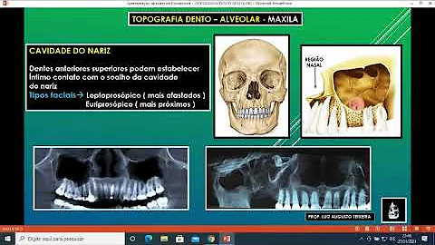 Quais as principais causas de infecção odontogênica?