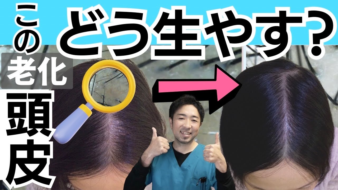 Important] These two scalps are really hard to grow hair! What is