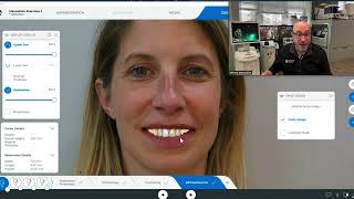 Smile Design sur CEREC Primescan