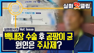 [실화탐사대] 곰팡이 균 폭증의 원인은 주사제?, MBC 210313 방송