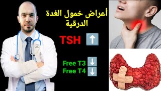 أعراض إرتفاع هرمون TSH و خمول وكسل الغدة الدرقية د يوسف الملاحي @Dr_youssef