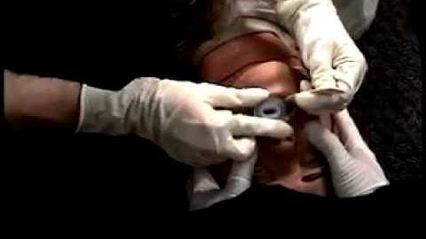 PHTLS 05 - OPA Insertion with Tounge Blade