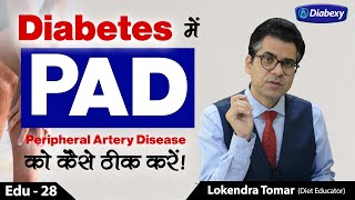 Leg pain in Diabetes | Diabexy EDU - 28