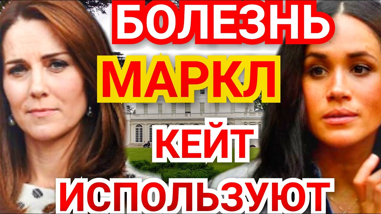 Меган фокс болезнь пальцев