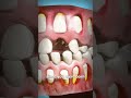 How adult teeth grow in 