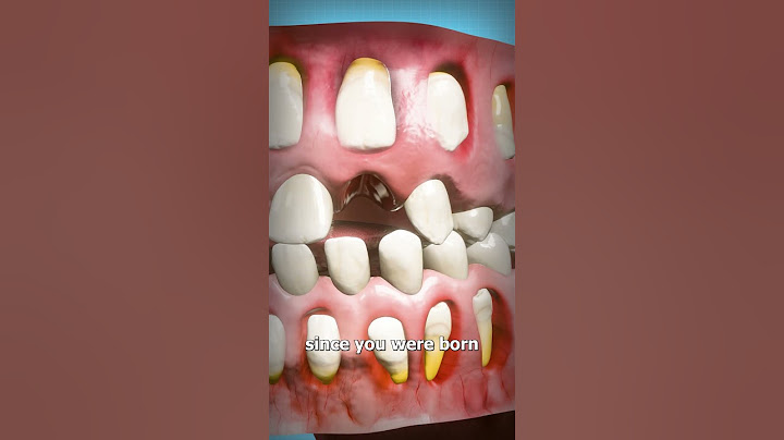 How Adult Teeth Grow In 🤔