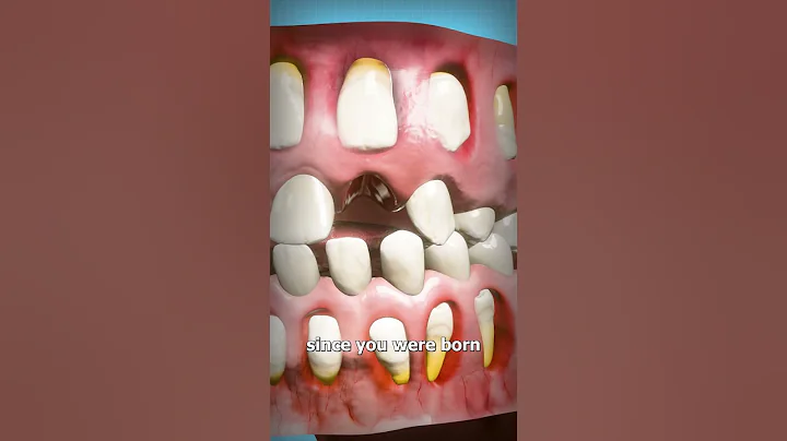 How Adult Teeth Grow In 🤔 - DayDayNews