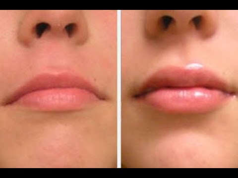 Video: Cómo Agrandar Los Labios Con Automasaje