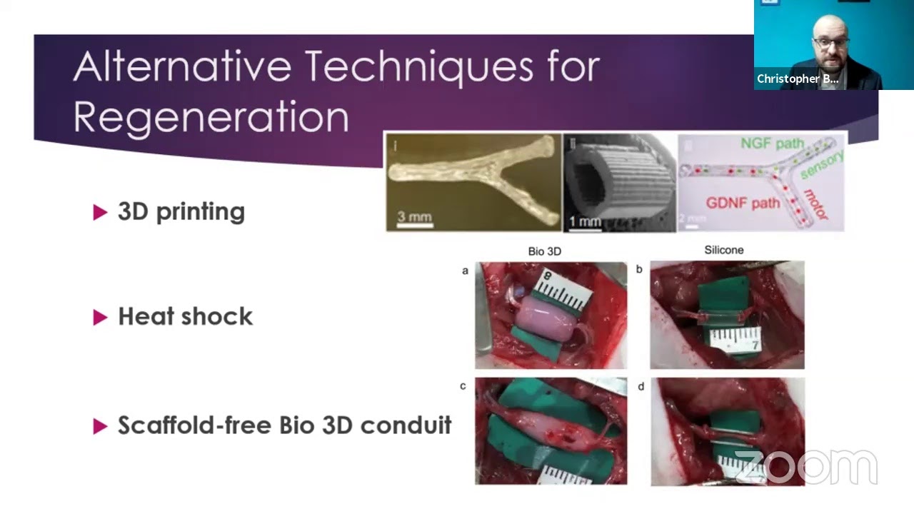 Dr. Christopher burtan: "A second chance--Exploring neural regeneration an restoration."