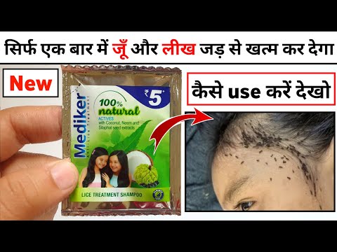 Mediker Shampoo How To | Mediker Anti Lice Treatment Review - YouTube