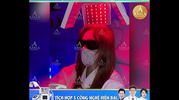 Trị rụng tóc kích mọc tóc bằng công nghệ cao 5 in 1 - điều trị hơn 10 nghìn ca mỗi năm