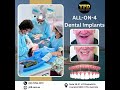 🦷 Transform Your Smile in a Day with All-on-4 Dental Implants!