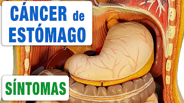 ¿Cómo se sospecha de un tumor?