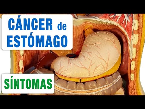 Vídeo: Picazón En El Estómago: Causas, Tratamiento Y Más