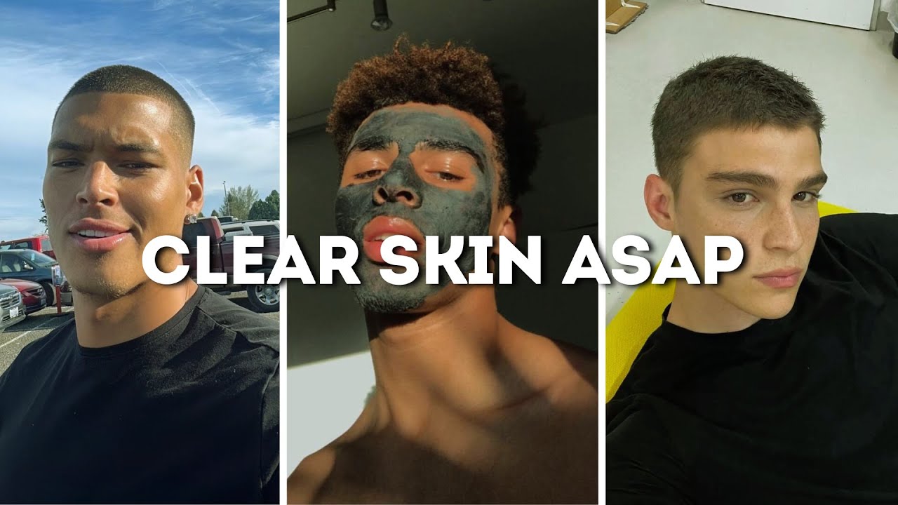 How to Get Clear Skin in 3 Simple Steps - YouTube