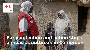 Early detection and action stop a measles outbreak in Cameroon
