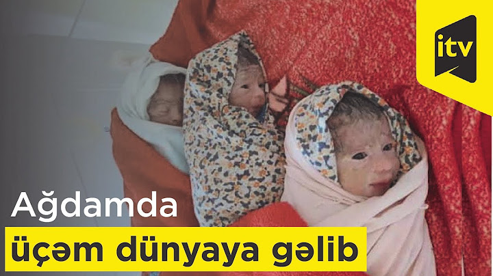 Ağdamda üçəm dünyaya gəlib