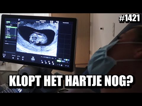 Video: Toxicose En Plassen Tijdens De Zwangerschap