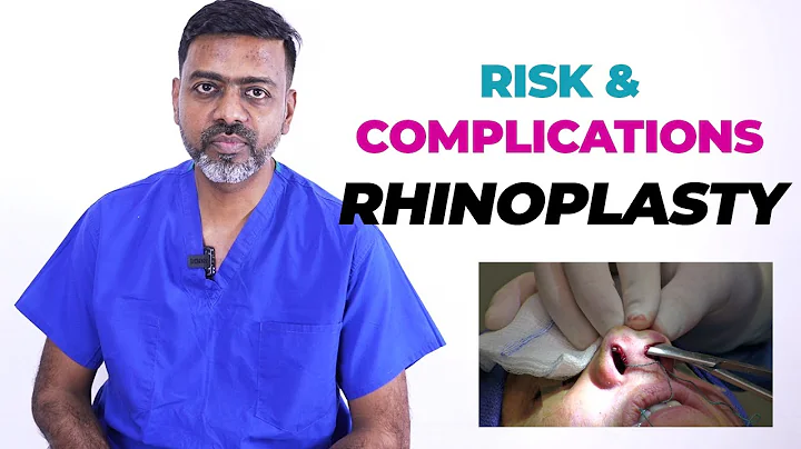 Riscos e complicações da rinoplastia: tudo o que você precisa saber