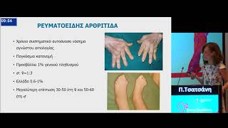 Αρθρίτιδα και ενηλικίωση - Τσατσάνη Παναγιώτα