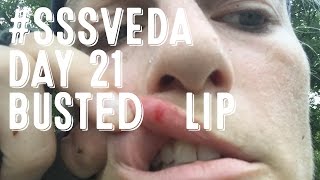 Day 21 - Busted Lip