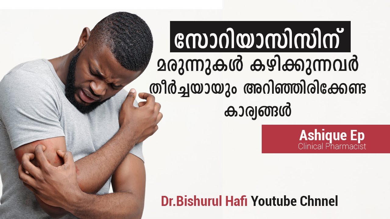 സോറിയാസിസിന് മരുന്നുകൾ കഴിക്കുന്നവർ തീർച്ചയായും അറിഞ്ഞിരിക്കേണ്ട കാര്യങ്ങൾ  | Psoriasis Malayalam