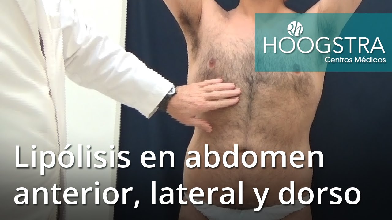 lipoma 意味 Lipólisis en abdomen anterior, lateral y dorso (16088)