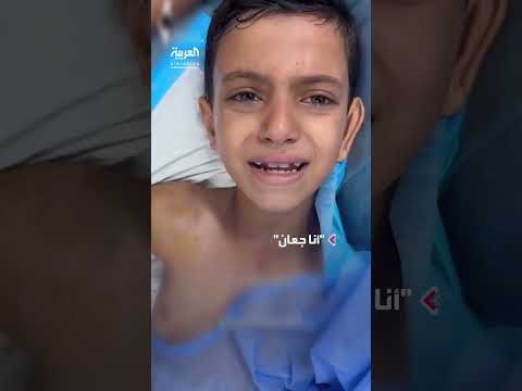 طفل غزي يعبّر عن ألم الجوع والقصف