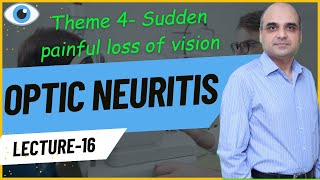 Optic Neuritis Lecture 16