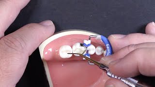 Celebrity Quick Tip #3 | Rolling the Marginal Ridge Wealth