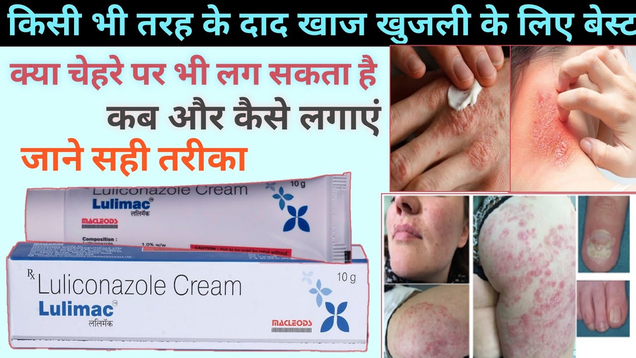 Lulimac cream | lulimac cream ke fayde | luliconazole cream uses in hindi | skin infection cream