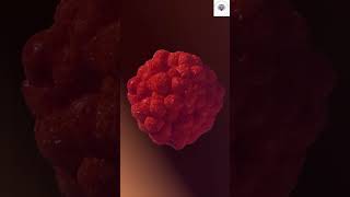 Genital Warts:A Barrier to Marriage? | Expert Info Dr.Sasi Kiran Attili | Best Dermatologist | Vizag