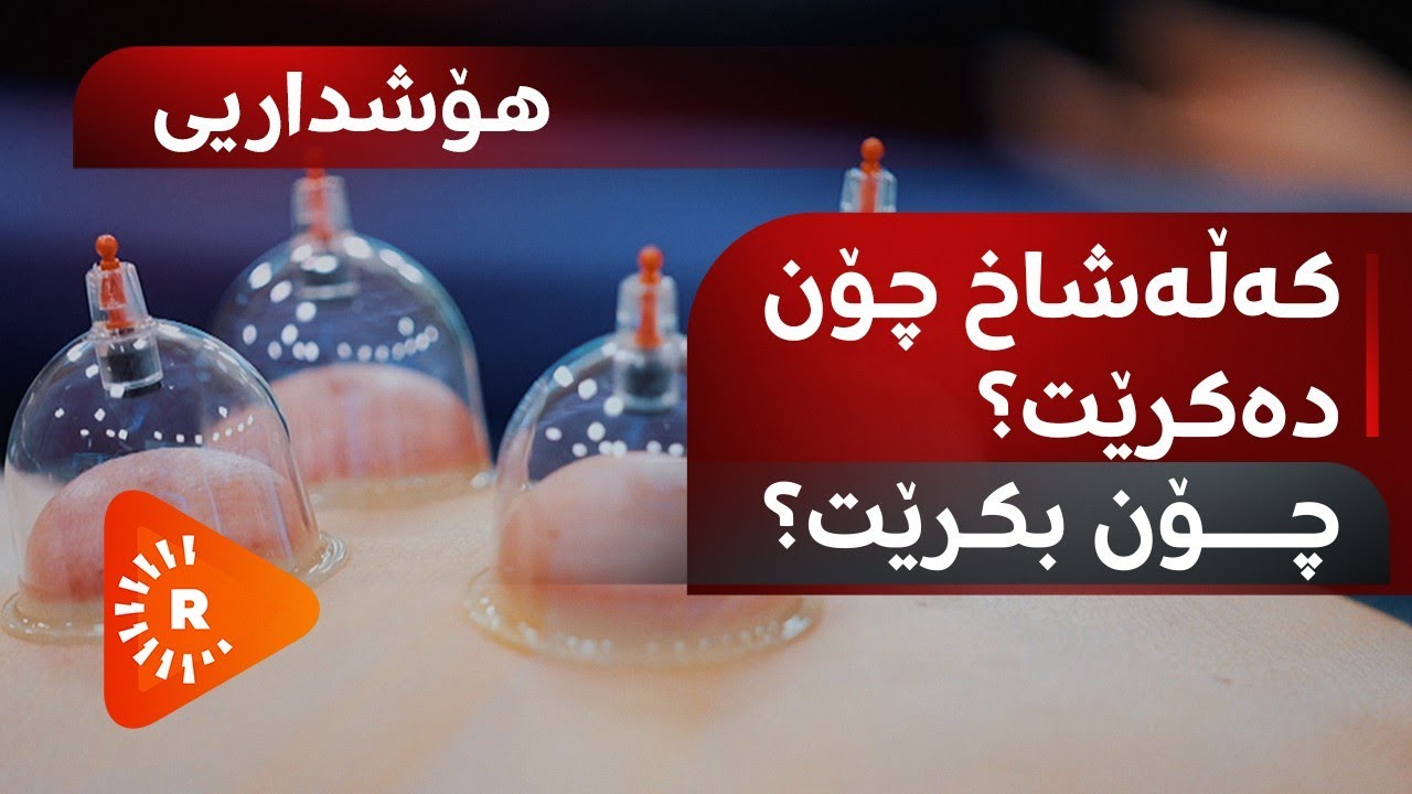 Dr Aras- دکتۆر ئاراس- هۆشداریی؛ کەڵەشاخ چۆن دەکرێت؟ چۆن بکرێت؟