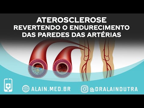Aterosclerose, revertendo o endurecimento e a formação de placas nas paredes das artérias