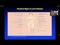 محاضره د طارق حسنين _ Basics   managment of cirrhotic patient