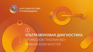 Ультразвуковая диагностика тромбозов глубоких вен нижних конечностей