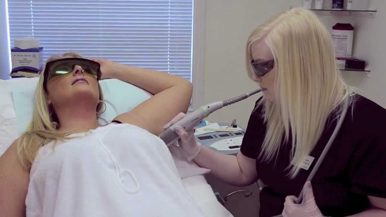 Laser Hair Removal Edmonton by Silky Skin Laser (780) 4686698 YouTube