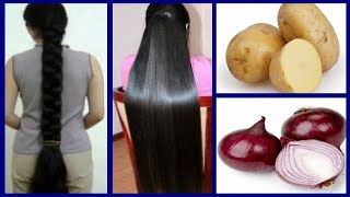 How To Grow Long and Thicken Hair Faster With Onion & Potato  Super Fast Hair Growth Challenge