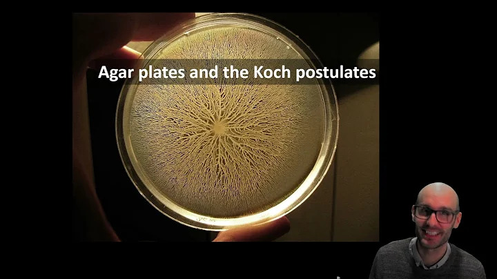 The invention of agar plates and how they are used...