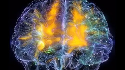 3D Brain Visualization