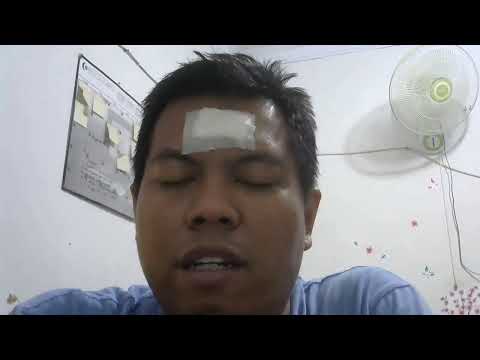 Video: Apakah ada operasi dahi?