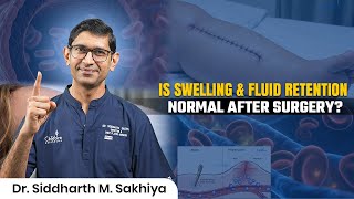 Swelling and Fluid Retention After Surgery | What’s Normal & When to Worry.