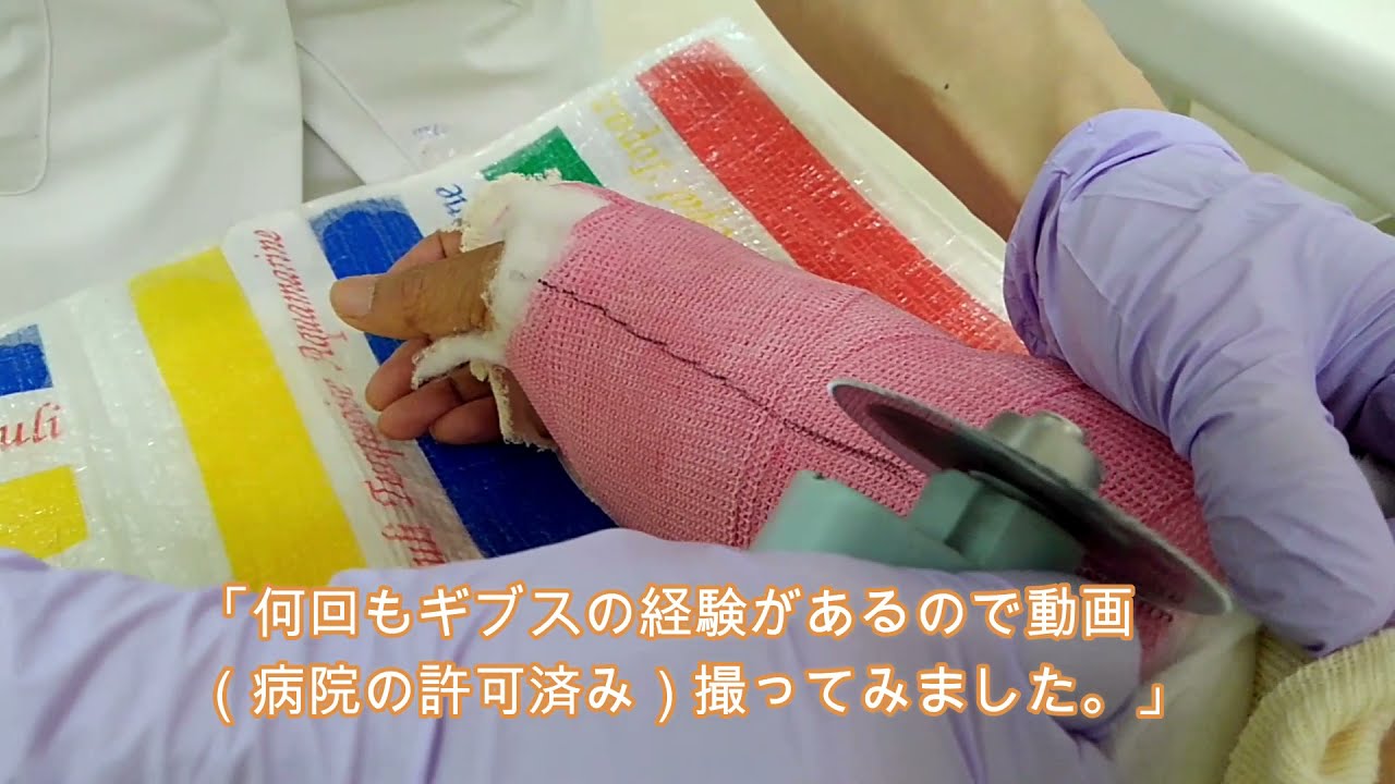 ギブスから固定へ‼