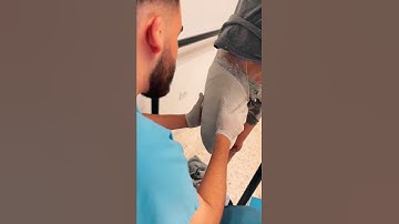 Casting Above Knee Amputees: Step-by-Step Prosthetic Fitting Process