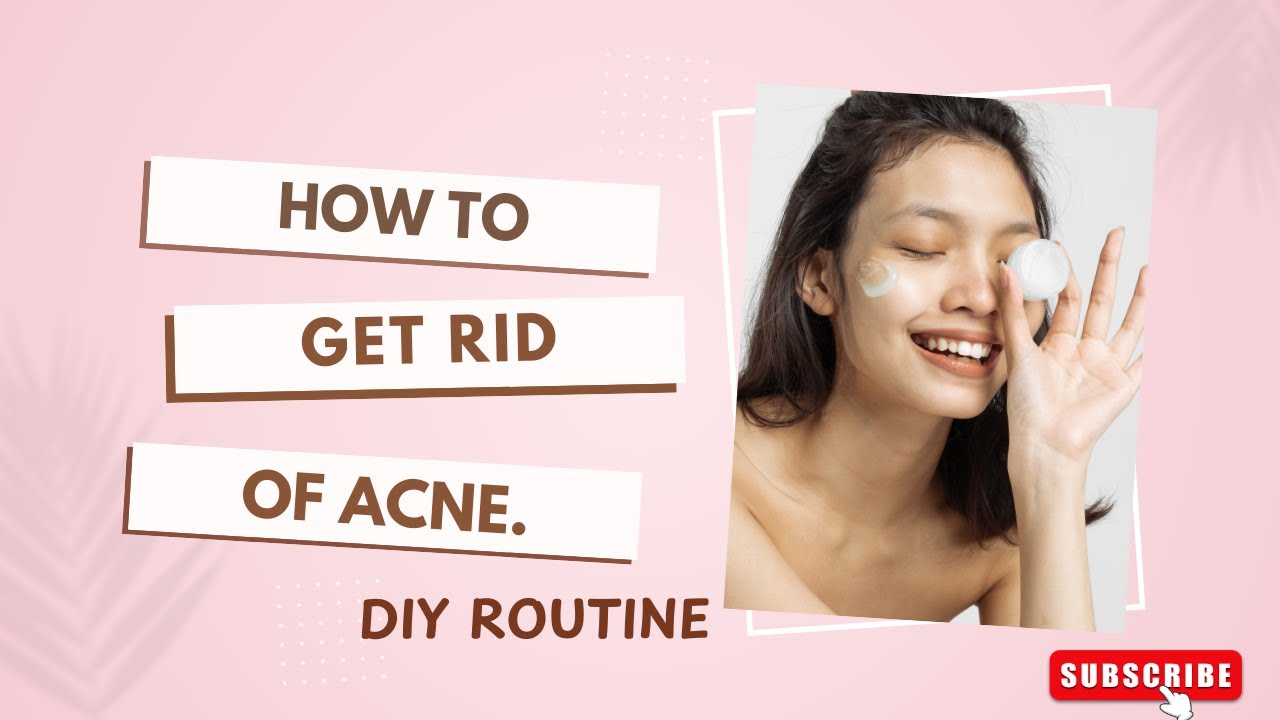 How to get rid of acne | DIY ROUTINE - YouTube