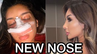 Why I got my nose done.