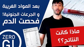 فحصت الدم بعد كل المواد الغريبة و الجرعات الجنونية من الفيتامينات | ماذا كانت النتيجة؟