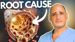 SHOCKING TRUTH About Cholesterol from a Heart Surgeon