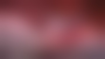 Asvide: Robot-assisted left lateral & posterior basal segmentectomy (S9+10) with multimodal...